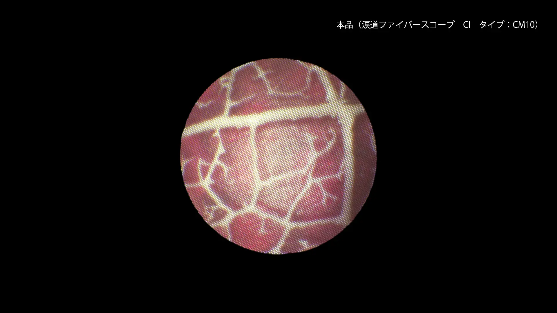 涙道ファイバースコープCM10