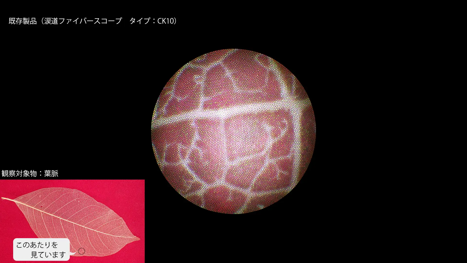 涙道ファイバースコープCK10